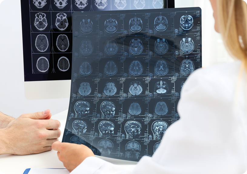 Revisando radiografías