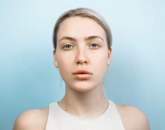 Parálisis Facial