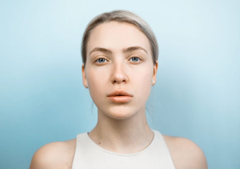 Parálisis Facial