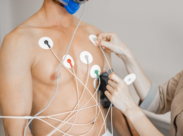 Electrodos